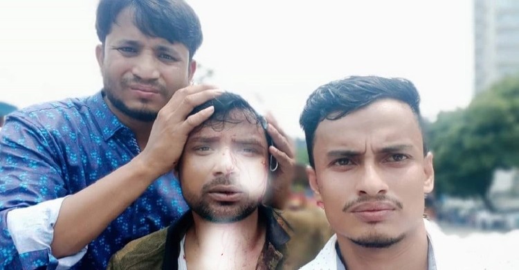 ঢাবিতে ভর্তি পরীক্ষার্থীদের সহায়তায় এসে হামলার শিকার ছাত্রদল