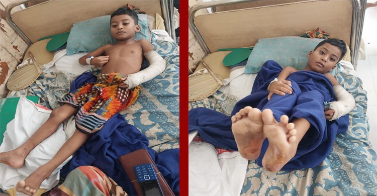 পায়ুপথে গরম ছ্যাকা সহ অমানুষিক নির্যাতনের শিকার শিশু- ইয়াছিন