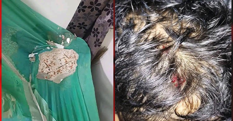 ঢাবির হলে ছাদের পলেস্তারা খসে পড়ল ঘুমন্ত শিক্ষার্থীর মাথায়