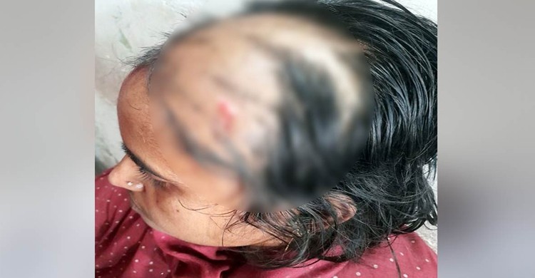 শিবগঞ্জে গৃহবধূকে মারধর করে চুল কেটে দেওয়ায় অভিযোগ