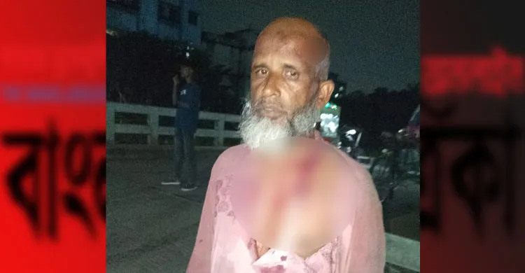 নারায়ণগঞ্জ ফতুল্লায় ব্যানার লাগাতে গিয়ে রক্তাক্ত  জামায়াতের রুকন