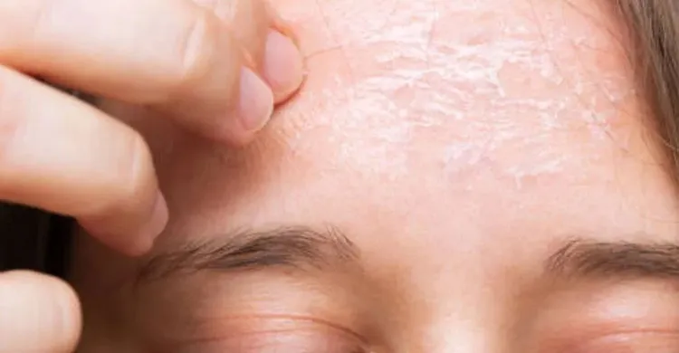 শীতে শুষ্ক ত্বকের যত্নে কার্যকর ৩ প্রাকৃতিক ক্লিনজার