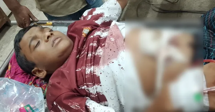 নারায়ণগঞ্জে ঝুট ব্যবসা নিয়ে দুই পক্ষের সংঘর্ষ, গুলিবিদ্ধ ৩