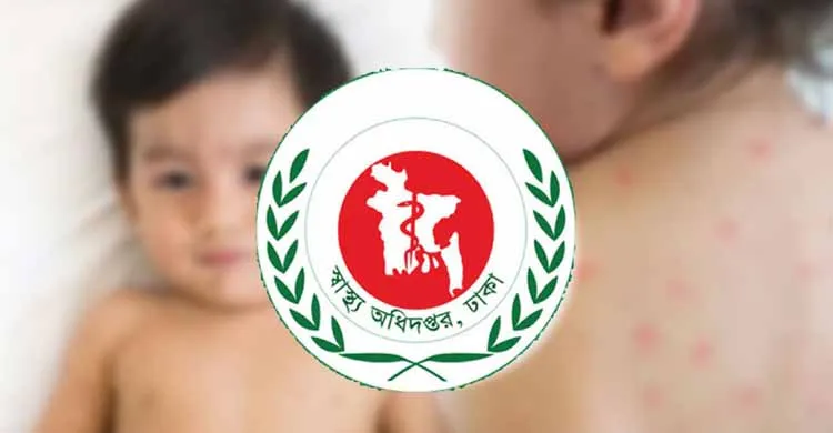 ২৪ ঘণ্টায় হাম ও উপসর্গে আরও ৯ শিশুর মৃত্যু