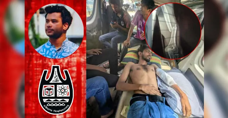 চবিতে র‍্যাগিংয়ের প্রতিবাদ করায় সংঘর্ষ, লাঠির আঘাতে ভাঙল শিক্ষার্থীর হাত