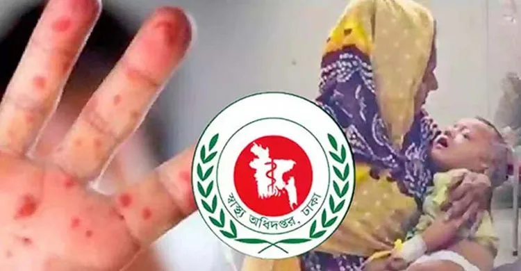 হামজনিত শিশুমৃত্যু হাজার ছাড়াল