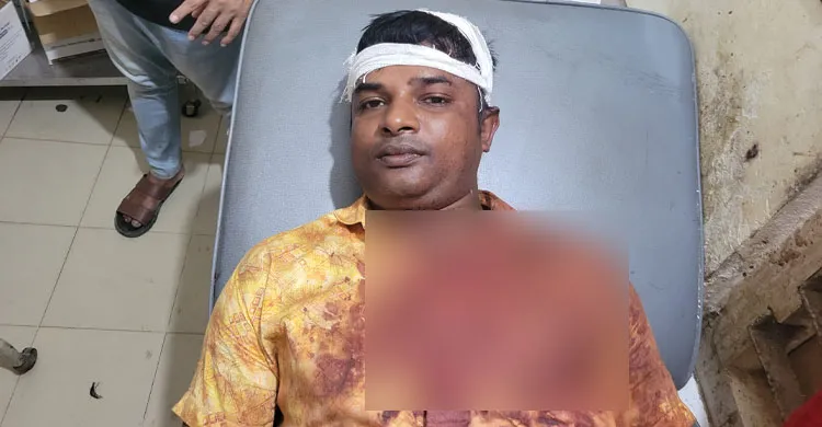 ধর্মপাশায় জমির বিরোধে স্কুলের সামনে প্রধান শিক্ষককে কুপিয়ে জখম